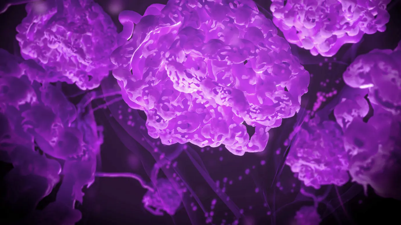 Prediction of IgAN disease progression